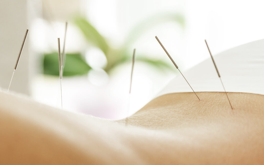 10 Things You Didn’t Know About Acupuncture and Traditional Chinese Medicine