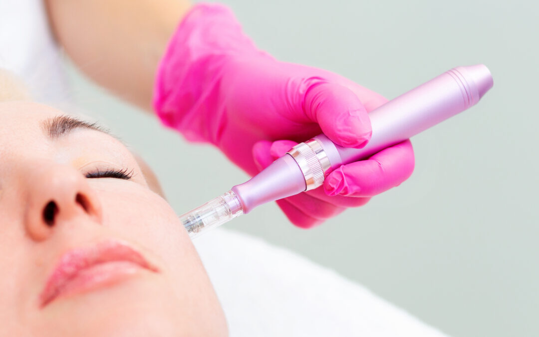 Health Benefits of Microneedling