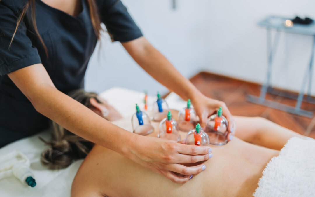What is Cupping Therapy, Anyway (And What Are the Top 4 Benefits it Provides)?