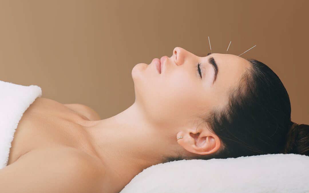 What Can Acupuncture Treat?