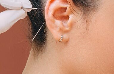 How the Secrets of Battlefield Acupuncture Can Help Us Wage War on Trauma