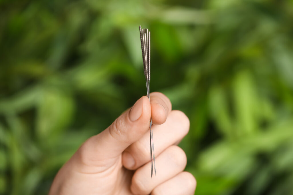 Female hand holding needles for acupuncture on blurred green background for acupuncture for allergy relief blog.