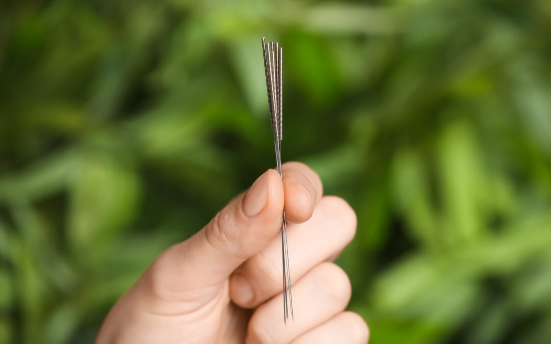 4 Reasons to Pursue Acupuncture for Allergy Relief