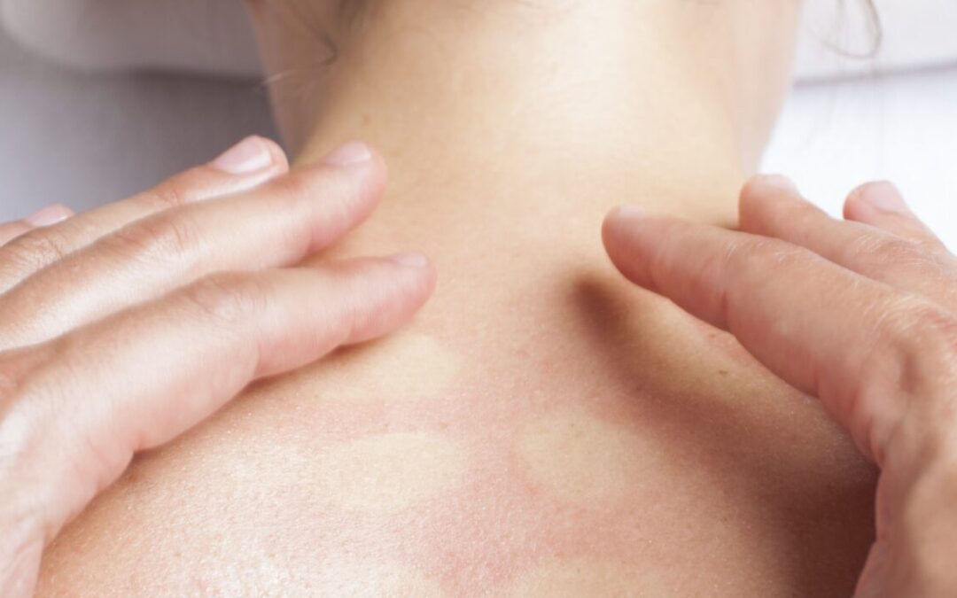What is Myofascial Massage? Unlocking the Benefits of This Therapeutic Technique