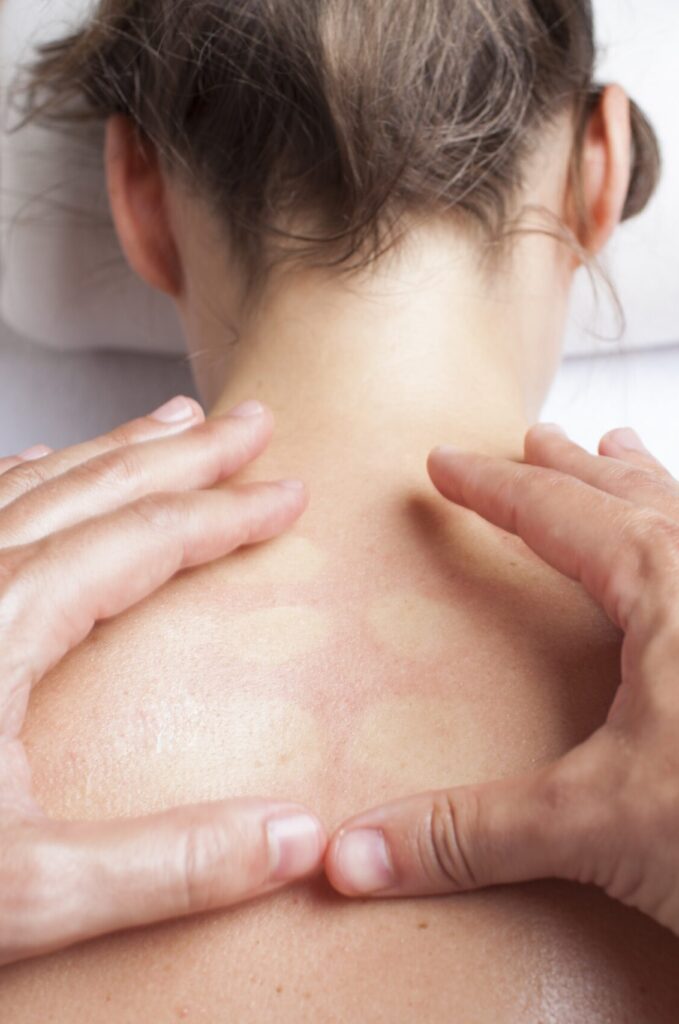 what is a myofascial massage