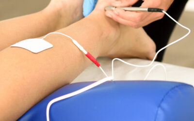 What Does Electrical Stimulation Do in Acupuncture?