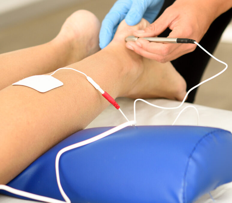 What Does Electrical Stimulation Do in Acupuncture?