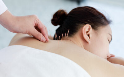 Can Acupuncture Help Autoimmune Disease?