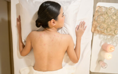 Can Acupuncture Help Menopause?