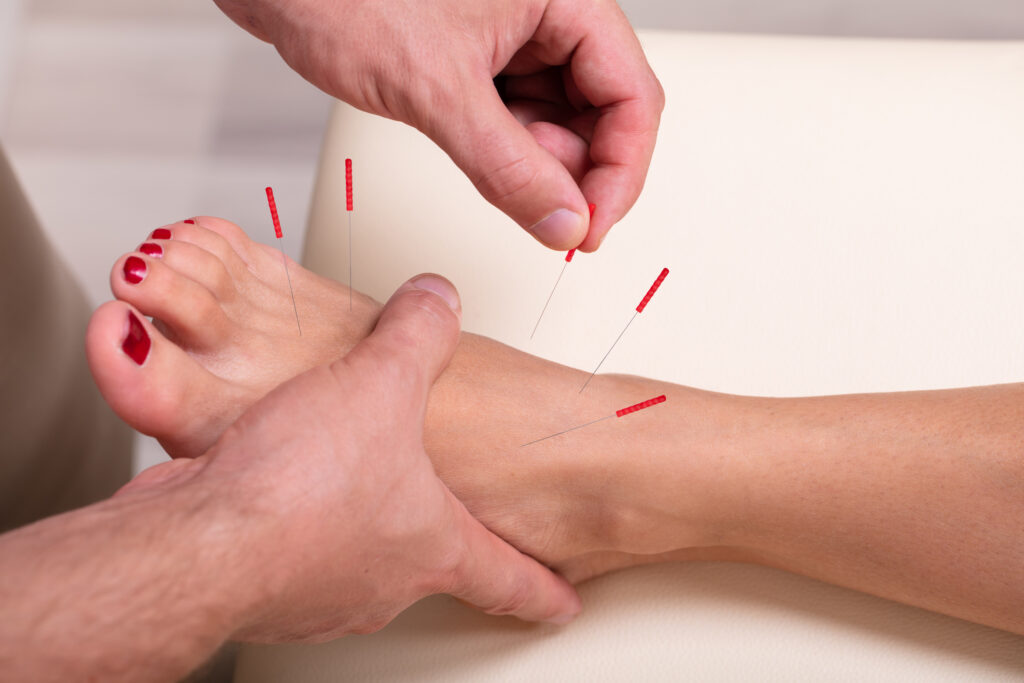 Can acupuncture help with foot pain?
