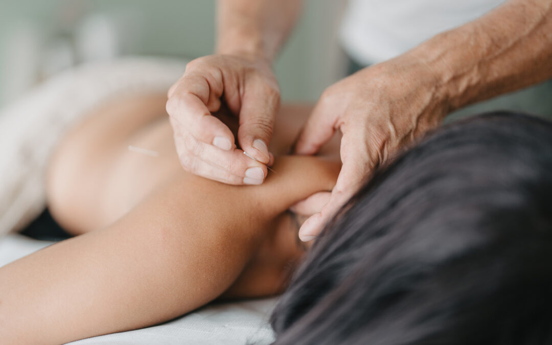 Can Acupuncture Help with Neuropathy?