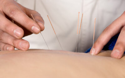 Can Acupuncture Help with IBS and Crohn’s Disease? Traditional Chinese Medicine’s Impact on Gut Health