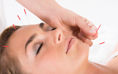 Can Acupuncture Improve Your Focus?
