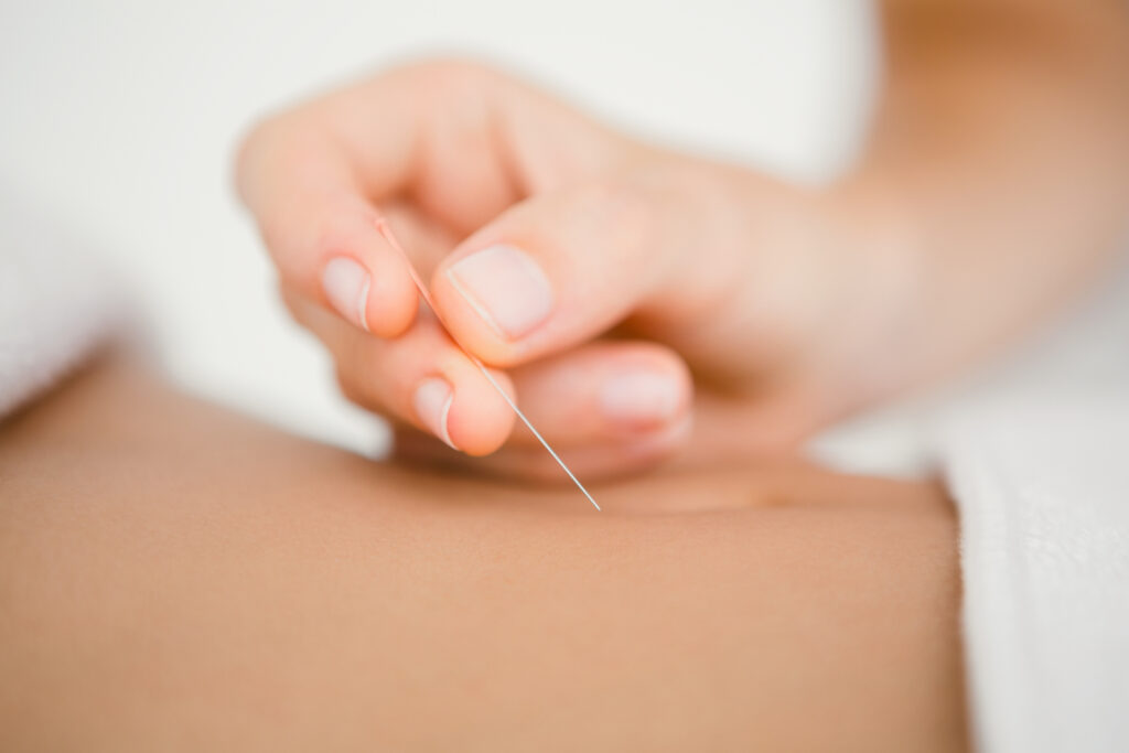 can acupuncture help with digestive issues