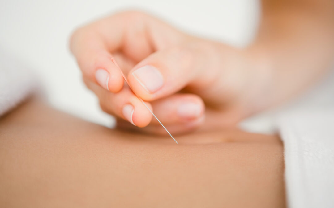 Can Acupuncture Help with Digestive Issues?