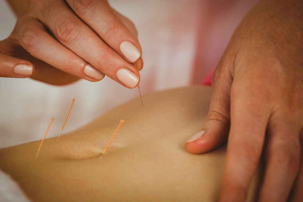 can acupuncture help with fertility