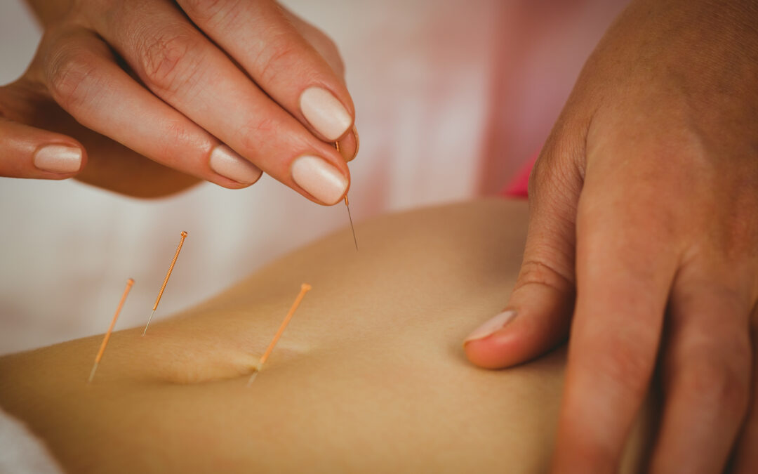 Can Acupuncture Help with Fertility?