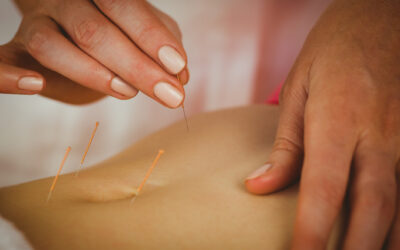 Can Acupuncture Help with Fertility?