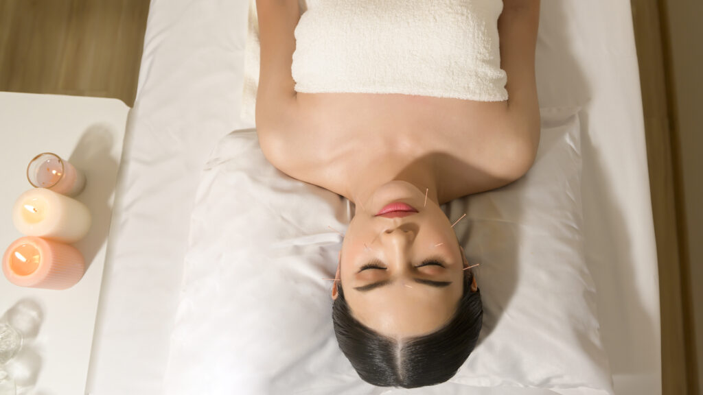 what happens to your body after acupuncture