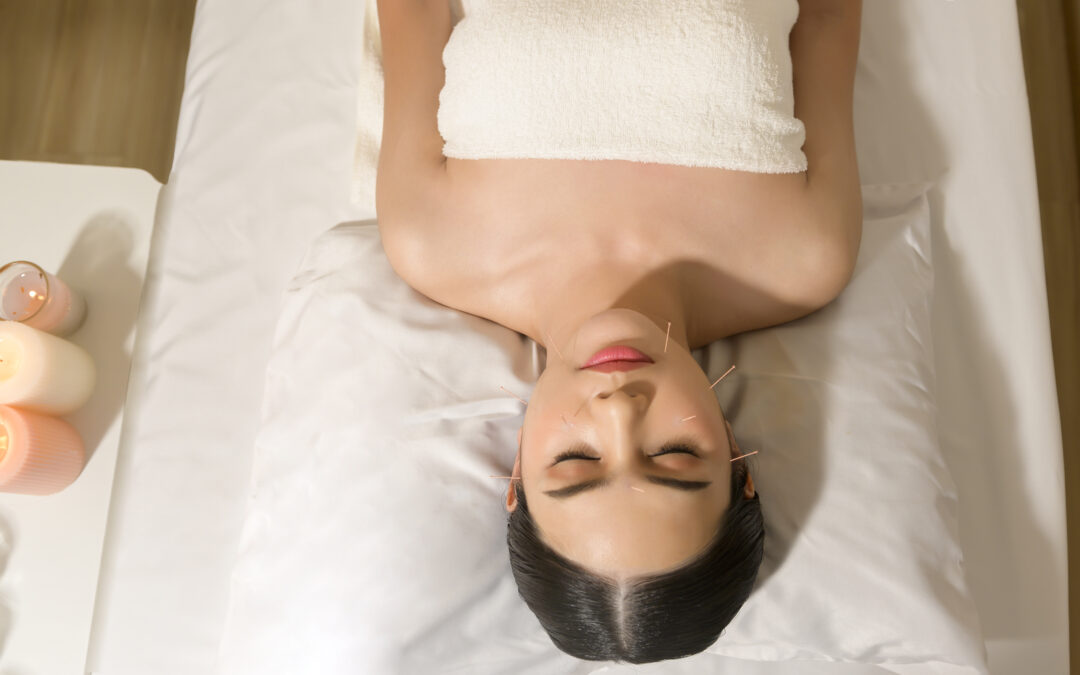 What Happens to Your Body After Acupuncture?