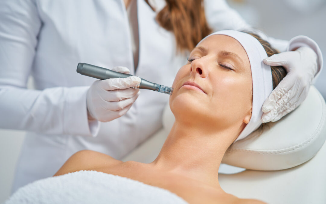 Does Microneedling Work?