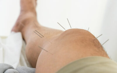 Does Acupuncture Treat Inflammation?