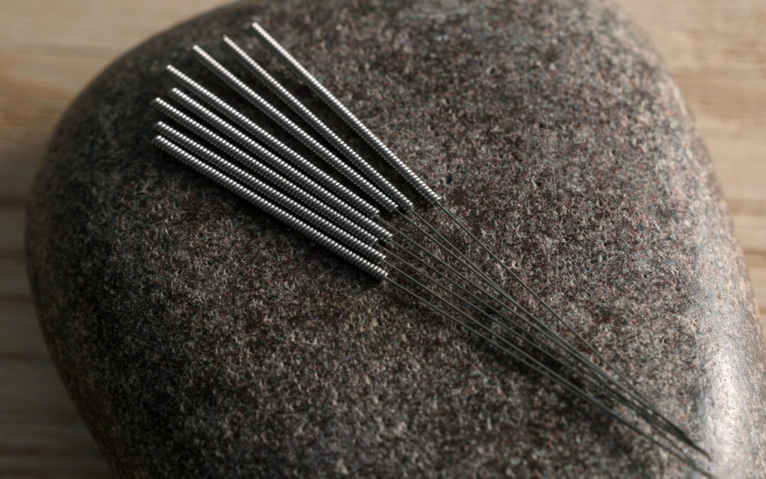 Can Acupuncture Help with ED?