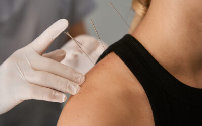 Can Acupuncture Enhance Athletic Performance?