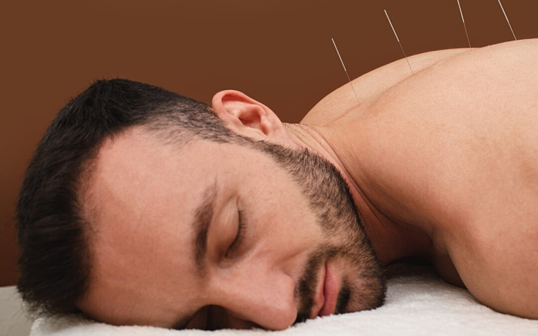 How Can I Integrate Acupuncture into My Wellness Routine?