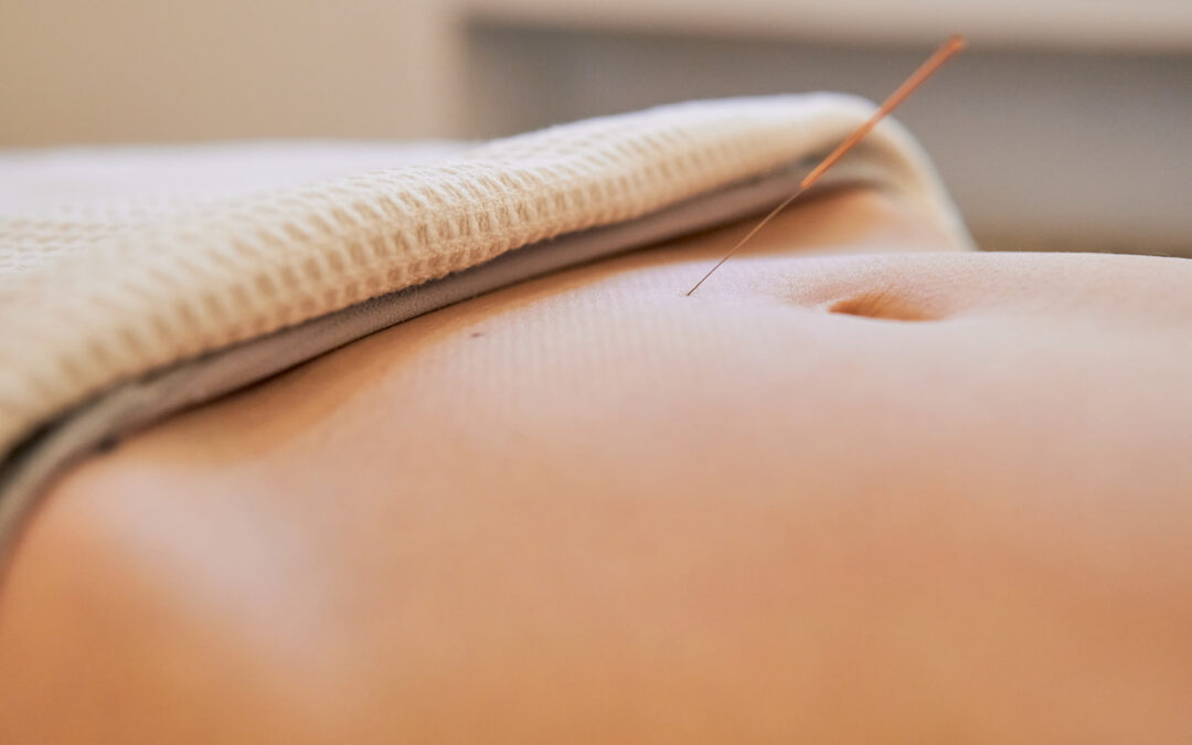 Can Acupuncture Help with Fertility?