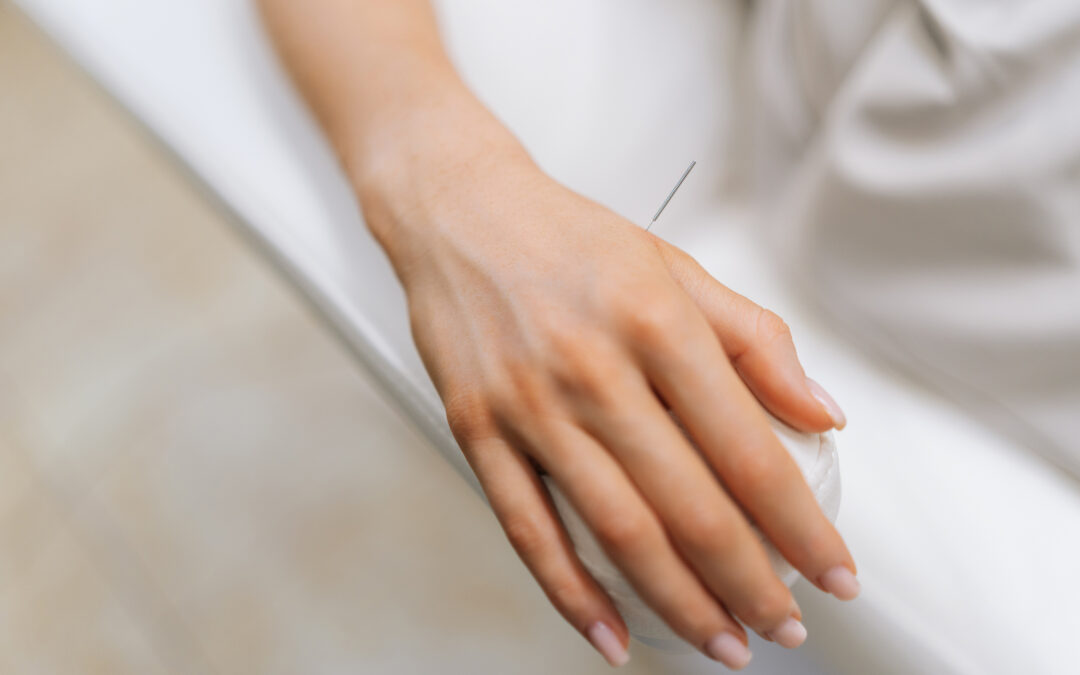 Can Acupuncture Support Heart Health?