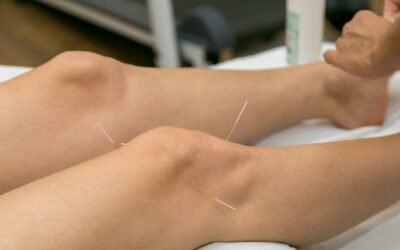 Can Acupuncture Support Bone Health & Osteoporosis?