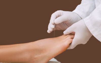 Traditional Chinese Medicine and Post-Surgical Recovery